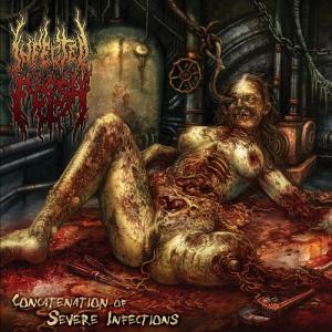 Concatenation Of Severe Infections cover art